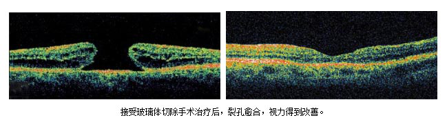 看东西变形