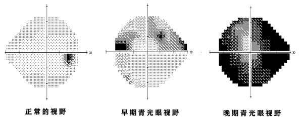 眼干用什么眼药水？