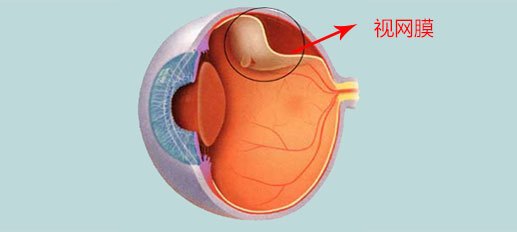 眼前有黑影，视网膜裂孔，视力持续下降，视野缺损，视网膜脱落早期症状，视网膜脱落的治疗方法