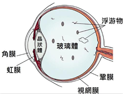 看东西有闪光感是什么原因造成