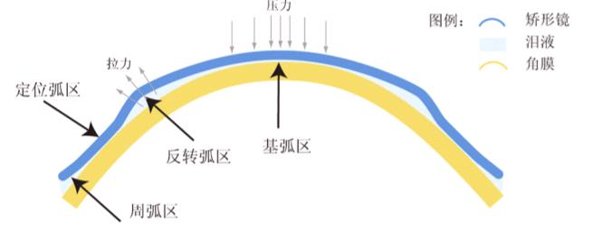 昆明哪里可以配OK镜？