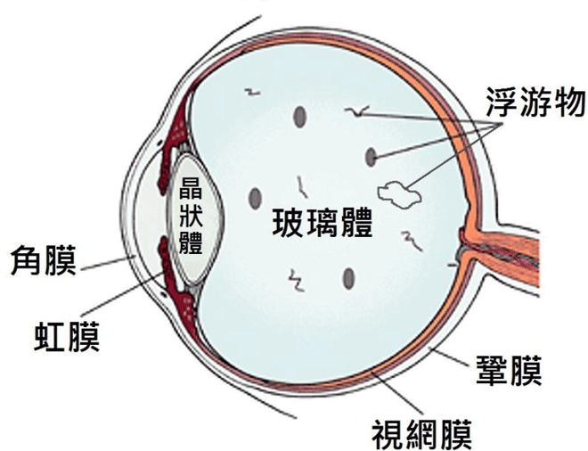 昆明眼底病治疗