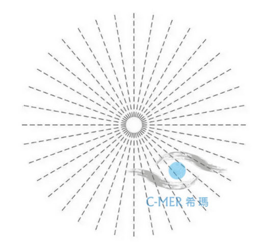 散光如何矫正